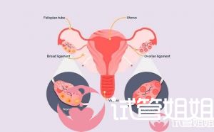 多囊卵巢综合征为什么不怀孕？