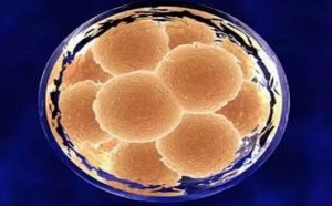 泰国试管容易成功吗？哪些人做试管婴儿更容易成功