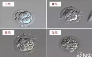 2022年赴美国试管婴儿医院必看篇，快收藏起来？