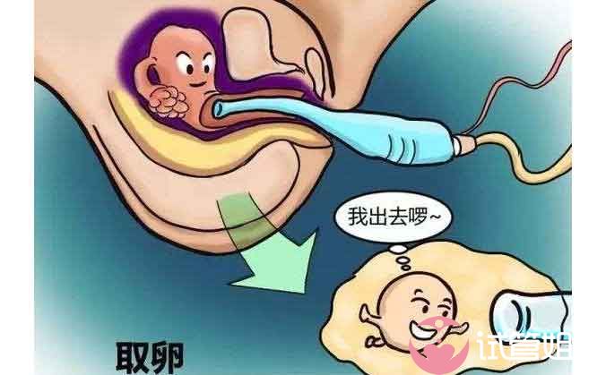 试管取卵疼吗