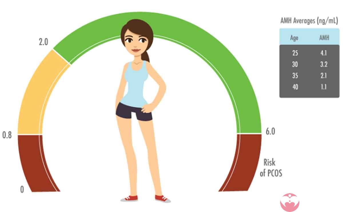 AMH可用于辅助诊断多囊卵巢综合征