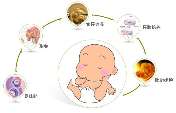 柬埔寨试管要多少钱呀 我们去了解一下详细的费用