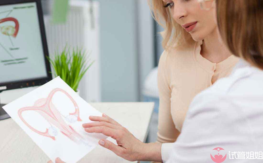 多囊卵巢综合征可以做美国试管婴儿吗