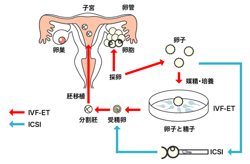 试管第二代和第三代有什么区别，都有哪些适应症呢？