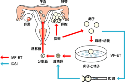 试管第二次移植费用