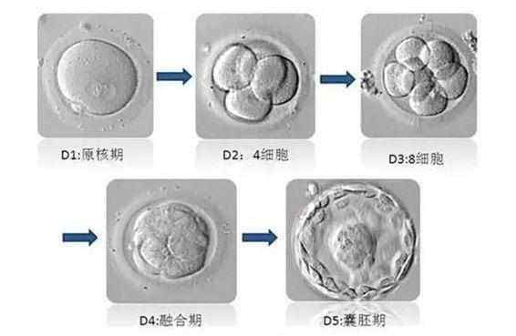 鲜胚移植