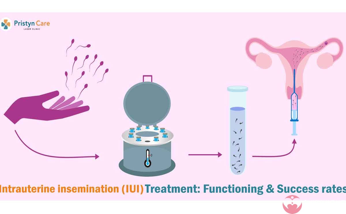 在深圳私立医院做完三代试管婴儿移植之后一直腹痛是为什么
